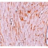 Immunohistochemistry - ZBTB7A Antibody from Signalway Antibody (25246) - Antibodies.com