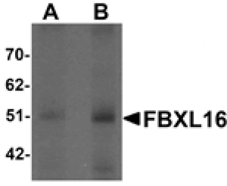 Western blot - FBXL16 Antibody from Signalway Antibody (25254) - Antibodies.com