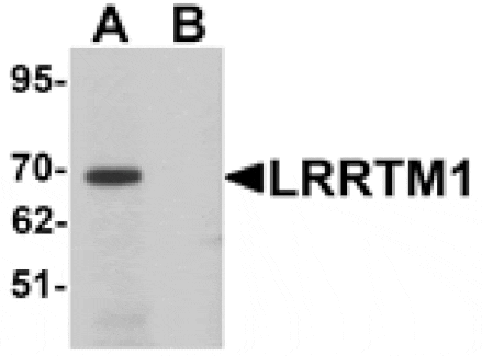 Western blot - LRRTM1 Antibody from Signalway Antibody (25255) - Antibodies.com