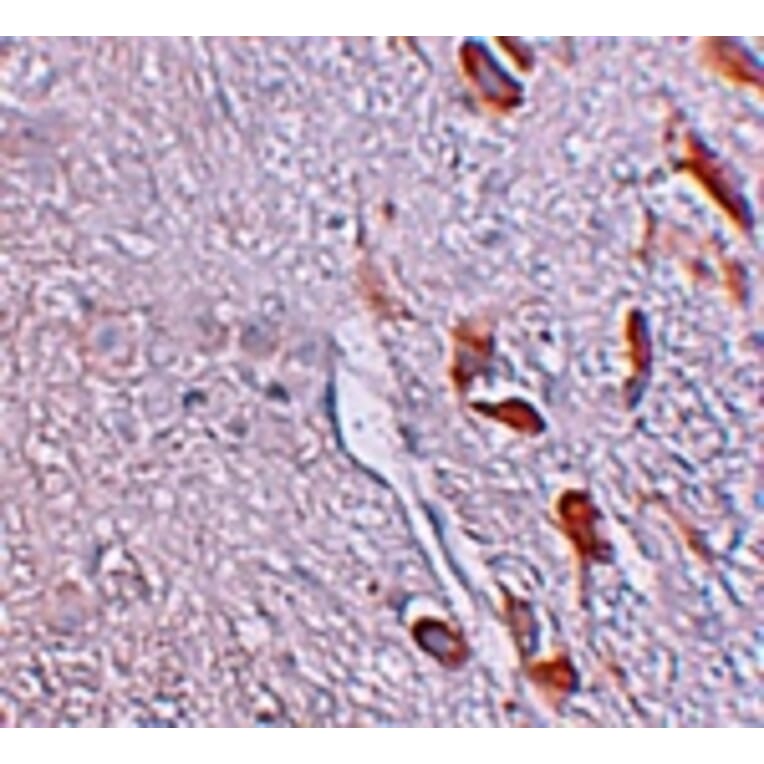Immunohistochemistry - LRRTM1 Antibody from Signalway Antibody (25255) - Antibodies.com