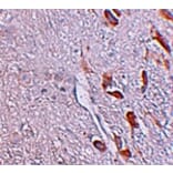 Immunohistochemistry - LRRTM1 Antibody from Signalway Antibody (25255) - Antibodies.com