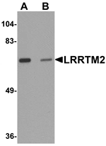 Western blot analysis of LRRTM2 in SK-N-SH cell lysate with LRRTM2 antibody at 1 µg/mL in (A) the absence and (B) the presence of blocking peptide.