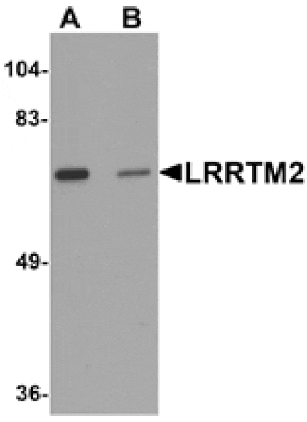 Western blot - LRRTM2 Antibody from Signalway Antibody (25256) - Antibodies.com
