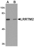 Western blot - LRRTM2 Antibody from Signalway Antibody (25256) - Antibodies.com
