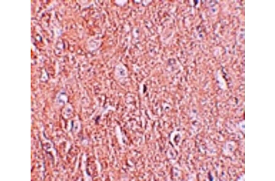 Immunohistochemistry - LRRTM2 Antibody from Signalway Antibody (25256) - Antibodies.com