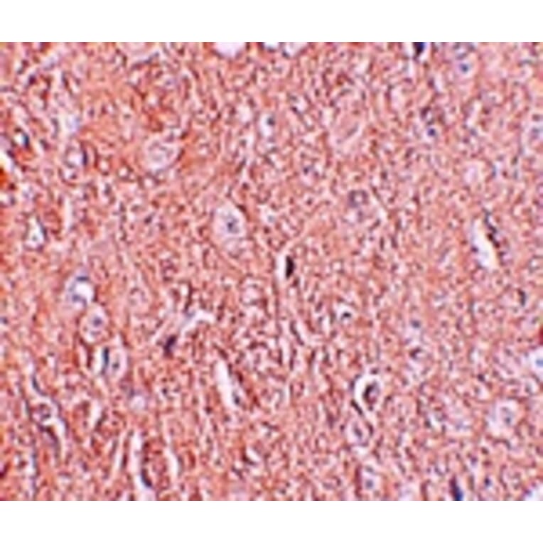 Immunohistochemistry - LRRTM2 Antibody from Signalway Antibody (25256) - Antibodies.com