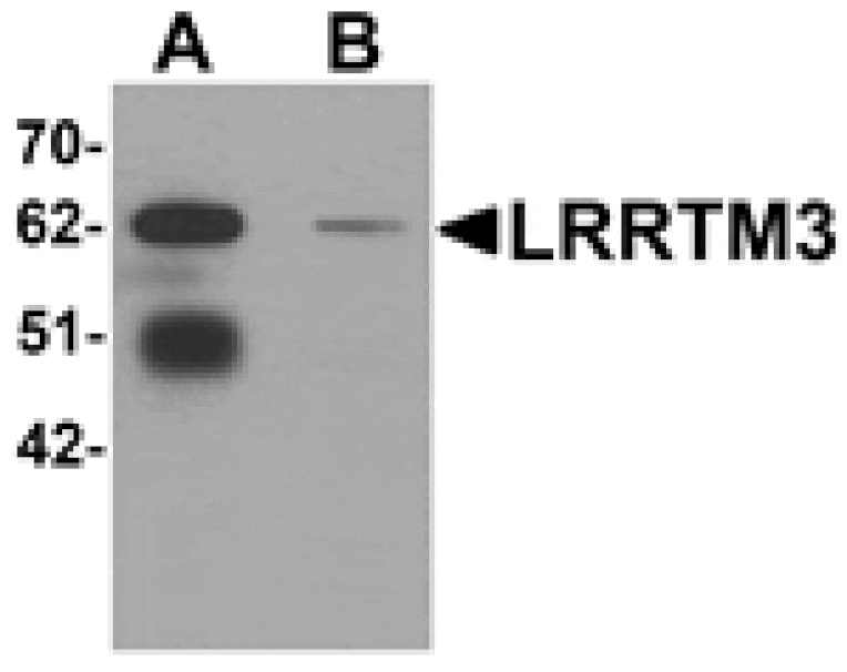 Western blot - LRRTM3 Antibody from Signalway Antibody (25257) - Antibodies.com