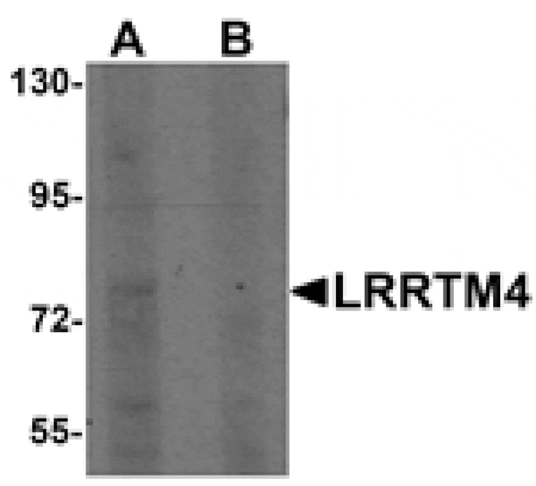 Western blot - LRRTM4 Antibody from Signalway Antibody (25258) - Antibodies.com