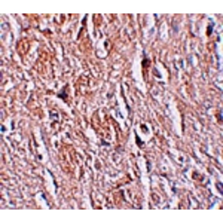 Immunohistochemistry - LRRTM4 Antibody from Signalway Antibody (25258) - Antibodies.com