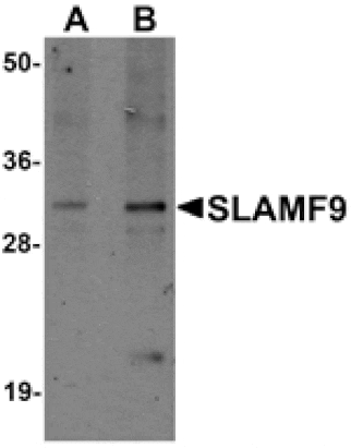 Western blot - SLAMF9 Antibody from Signalway Antibody (25262) - Antibodies.com