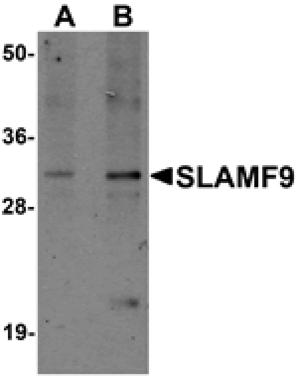 Western blot - SLAMF9 Antibody from Signalway Antibody (25262) - Antibodies.com