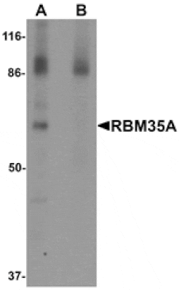 Western blot - RBM35A Antibody from Signalway Antibody (25264) - Antibodies.com