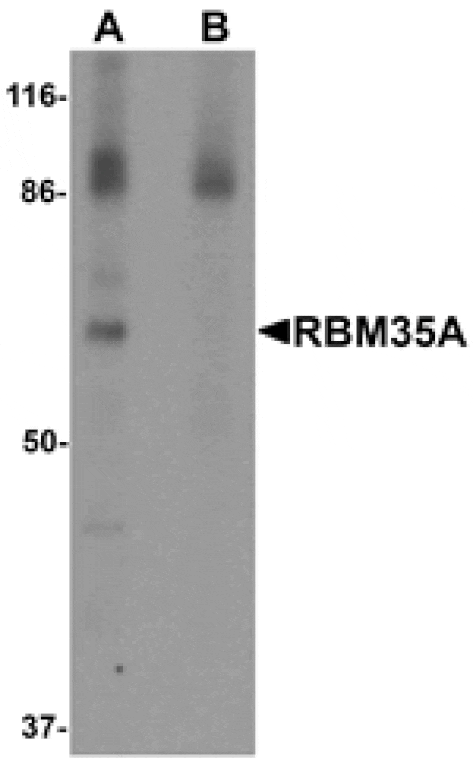 Western blot - RBM35A Antibody from Signalway Antibody (25264) - Antibodies.com