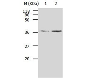 AKR1B1 Antibody from Signalway Antibody (31006) - Antibodies.com