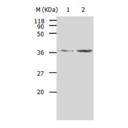 AKR1B1 Antibody from Signalway Antibody (31006) - Antibodies.com