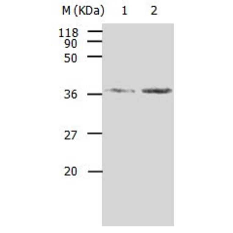 AKR1B1 Antibody from Signalway Antibody (31006) - Antibodies.com