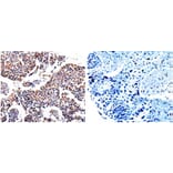 AKR1B1 Antibody from Signalway Antibody (31006) - Antibodies.com