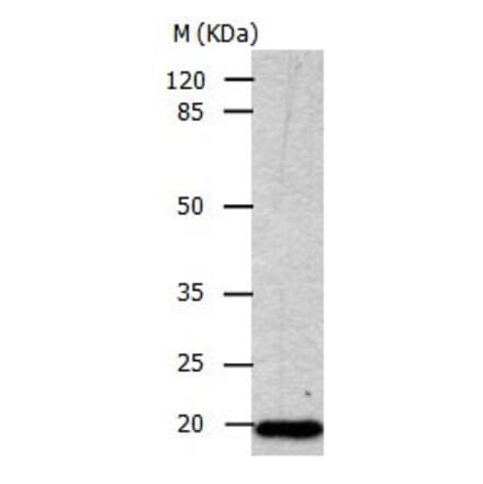 CDKN1A Antibody from Signalway Antibody (31014) - Antibodies.com