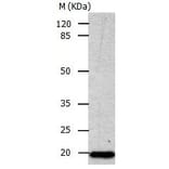CDKN1A Antibody from Signalway Antibody (31014) - Antibodies.com