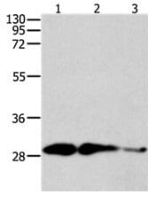 Gel: 12% SDS-PAGELane1: Mouse spleen tissue lysate Lane2: K562 cell lysateLane3: NIH/3T3 cell lysate. Lysates: 60 µg per lane. Primary antibody: 1/200 dilution. Secondary antibody: Goat anti Rabbit IgG - H&L (HRP) at 1/10000 dilution. Exposure time: 15 seconds