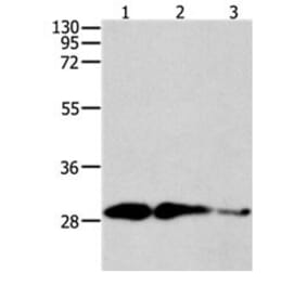 CAPNS1 Antibody from Signalway Antibody (31040) - Antibodies.com