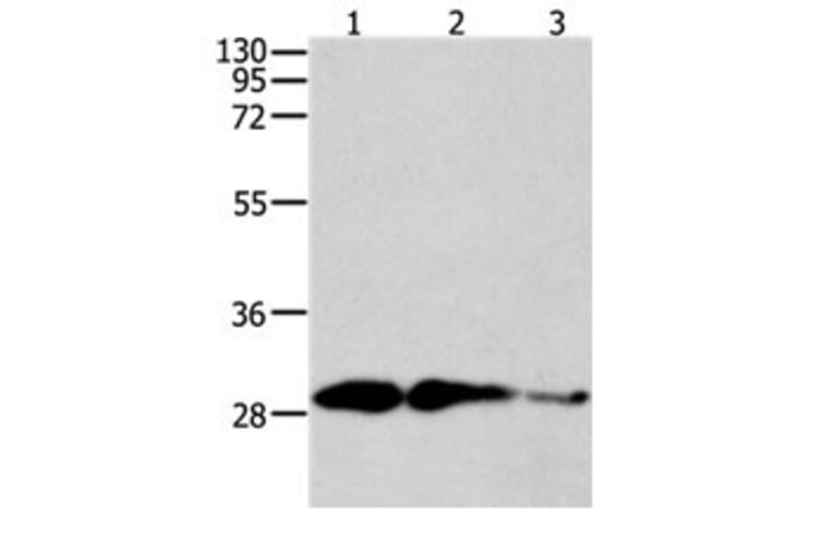 CAPNS1 Antibody from Signalway Antibody (31040) - Antibodies.com