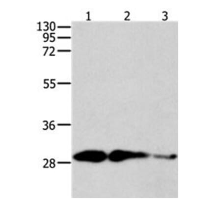CAPNS1 Antibody from Signalway Antibody (31040) - Antibodies.com