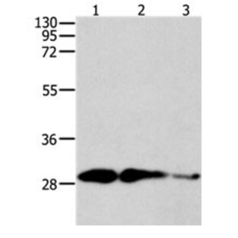 CAPNS1 Antibody from Signalway Antibody (31040) - Antibodies.com