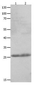 Gel: 12+10% SDS-PAGE Lane1: Human fetal kidney tissue lysate Lane2: Jurkat cell lysate. Lysates: 30 µg Primary antibody: 1/1100 dilution. Secondary antibody: Goat anti Rabbit IgG - H&L (HRP) at 1/10000 dilution. Exposure time: 30 seconds