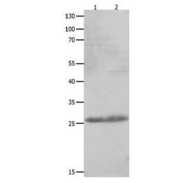 CLEC4D Antibody from Signalway Antibody (31059) - Antibodies.com