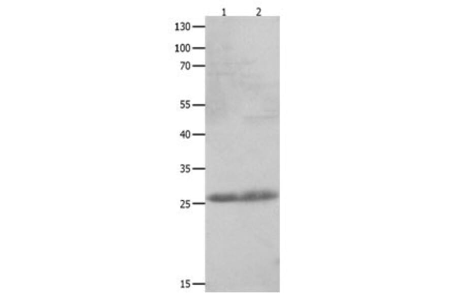 CLEC4D Antibody from Signalway Antibody (31059) - Antibodies.com