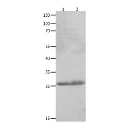 CLEC4D Antibody from Signalway Antibody (31059) - Antibodies.com