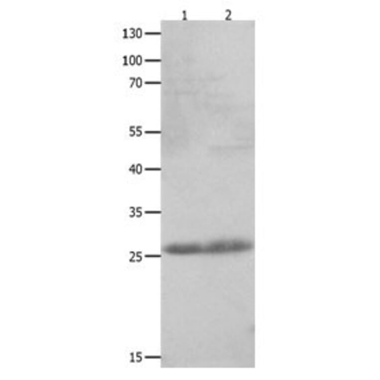 CLEC4D Antibody from Signalway Antibody (31059) - Antibodies.com