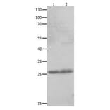 CLEC4D Antibody from Signalway Antibody (31059) - Antibodies.com