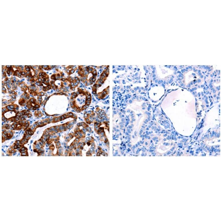 CLEC4D Antibody from Signalway Antibody (31059) - Antibodies.com