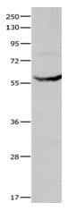 Gel: 10% SDS-PAGE Lysate: 30 µg Mouse liver tissue lysate Primary antibody: 1/400 dilution Secondary antibody: Goat anti Rabbit IgG - H&L (HRP) at 1/10000 dilution Exposure time: 5 seconds