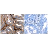 LGALS1 Antibody from Signalway Antibody (31074) - Antibodies.com