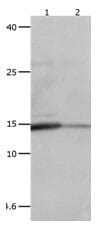 Gel: 15%+12% SDS-PAGELane1: Human liver Cancer tissue lysate Lane2: Human leiomyosarcoma tissue lysate. Lysates: 40 µg per lane. Primary antibody: 1/250 dilution. Secondary antibody: Goat anti Rabbit IgG - H&L (HRP) at 1/10000 dilution. Exposure time: 10 seconds