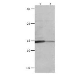 LGALS2 Antibody from Signalway Antibody (31075) - Antibodies.com