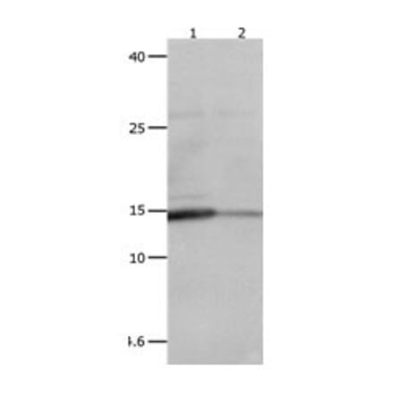 LGALS2 Antibody from Signalway Antibody (31075) - Antibodies.com