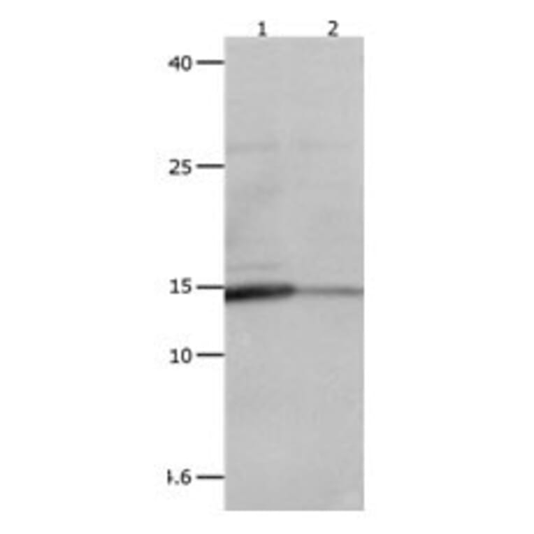 LGALS2 Antibody from Signalway Antibody (31075) - Antibodies.com