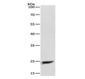 MAD2L1 Antibody from Signalway Antibody (31095) - Antibodies.com