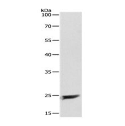 MAD2L1 Antibody from Signalway Antibody (31095) - Antibodies.com