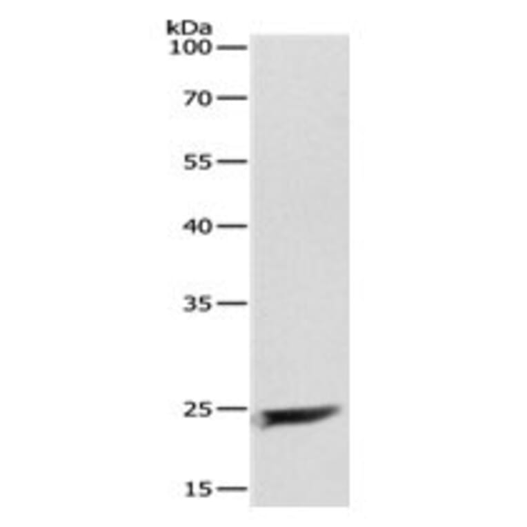 MAD2L1 Antibody from Signalway Antibody (31095) - Antibodies.com