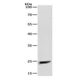 MAD2L1 Antibody from Signalway Antibody (31095) - Antibodies.com