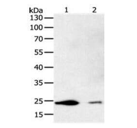 FBXO32 Antibody from Signalway Antibody (31096) - Antibodies.com