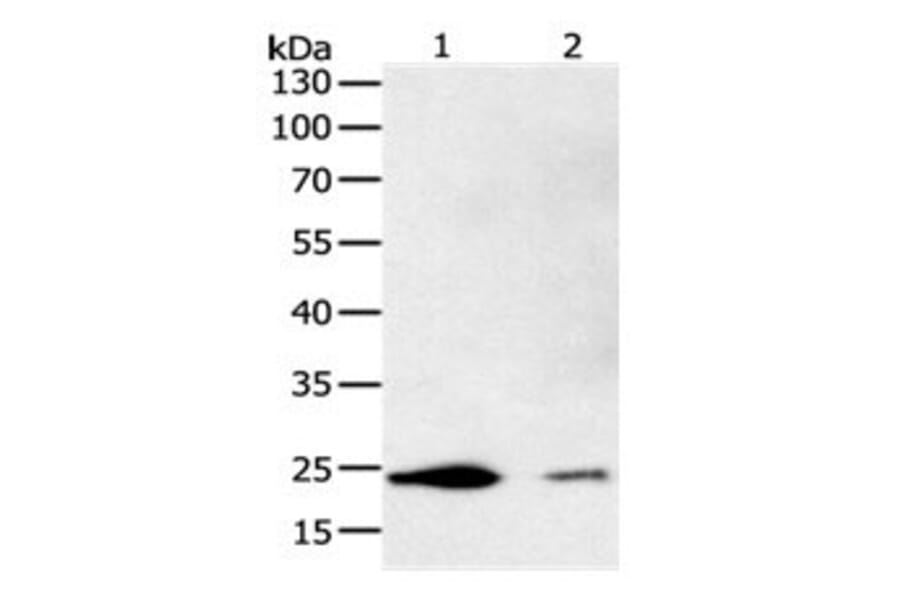 FBXO32 Antibody from Signalway Antibody (31096) - Antibodies.com