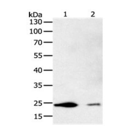 FBXO32 Antibody from Signalway Antibody (31096) - Antibodies.com
