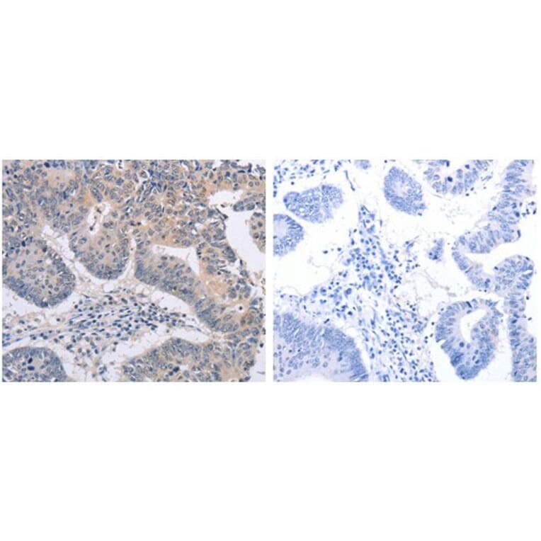 FBXO32 Antibody from Signalway Antibody (31096) - Antibodies.com