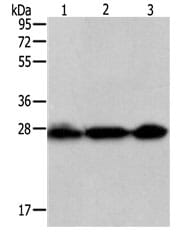 Gel: 12% SDS-PAGELane1: Hela cell lysate Lane2: Jurkat cell lysateLane3: 231 cell lysate. Lysates: 50 µg per lane. Primary antibody: 1/200dilutionSecondary antibody: Goat anti Rabbit IgG - H&L (HRP) at 1/10000 dilution. Exposure time: 10 seconds